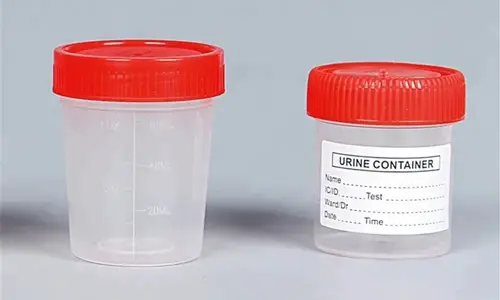 What Container Can I Use For A Urine Sample?
